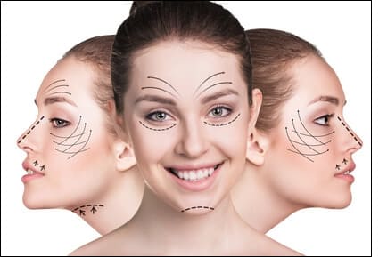 Das Facelift zur Verjüngung fortschreitender Hautalterung des Gesichts
